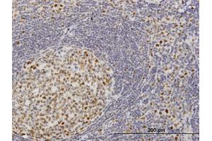 Immunoperoxidase of monoclonal antibody to TOE1 on formalin-fixed paraffin-embedded human tonsil. (TOE1 抗体  (AA 1-510))
