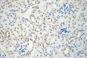 Immunohistochemistry was performed on paraffin-embedded mouse kidney using RAD51 recombinase antibody (ABIN7798367), 1:200). (Recombinant RAD51 抗体)