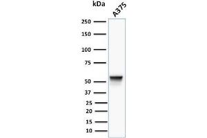 Western Blotting (WB) image for anti-Vimentin (VIM) antibody (ABIN6940879)