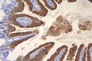 IHC analysis of Krt20 using anti-Krt20 antibody (ABIN7601133). (KRT20 抗体  (AA 29-431))