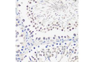 Immunohistochemistry of paraffin-embedded rat testis using PBK antibody (ABIN1682870, ABIN3019240, ABIN3019241 and ABIN6220784) at dilution of 1:100 (40x lens). (PBK 抗体  (AA 1-322))
