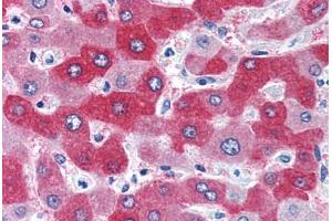Human Liver (formalin-fixed, paraffin-embedded) stained with FTCD antibody ABIN351477 at 3. (FTCD 抗体  (AA 203-216))