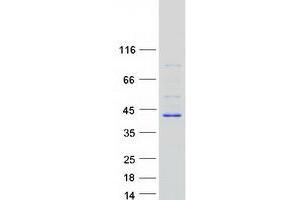 Western Blotting (WB) image for Biliverdin Reductase A (BLVRA) protein (Myc-DYKDDDDK Tag) (ABIN2715267)