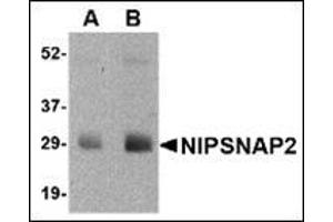 Western blot analysis of NIPSNAP2 in human skeletal muscle tissue lysate with this product at (A) 0. (GBAS 抗体  (N-Term))