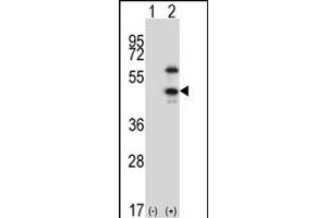 Western blot analysis of CDKL1 (arrow) using rabbit polyclonal CDKL1 Antibody  (ABIN391762 and ABIN2841627). (CDKL1 抗体  (C-Term))