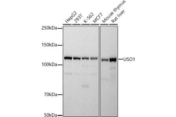 USO1 anticorps
