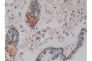 Immunohistochemistry (IHC) image for anti-Cysteine-Rich, Angiogenic Inducer, 61 (CYR61) (AA 176-379) antibody (ABIN7439291)