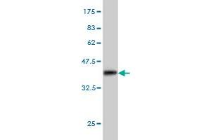 Western Blot detection against Immunogen (36. (MAP3K4 抗体  (AA 1201-1300))