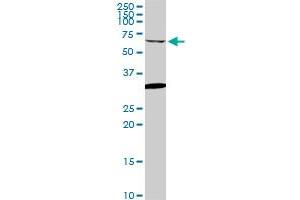 GRK6 monoclonal antibody (M06), clone 2G1. (GRK6 抗体  (AA 71-170))