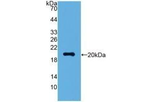 Detection of Recombinant VSNL1, Human using Polyclonal Antibody to Visinin Like Protein 1 (VSNL1) (VSNL1 抗体  (AA 39-184))