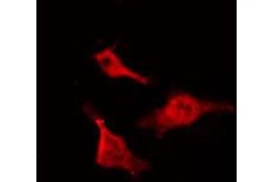 ABIN6267467 staining NIH-3T3 by IF/ICC. (CDC25B 抗体  (pSer323))