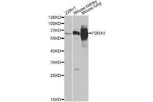 Western blot analysis of extracts of various cell lines, using P2RX4 antibody. (P2RX4 抗体)