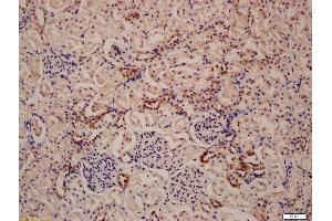 Immunohistochemistry (Paraffin-embedded Sections) (IHC (p)) image for anti-Lysosomal-Associated Membrane Protein 1 (LAMP1) (AA 301-417) antibody (ABIN676088)