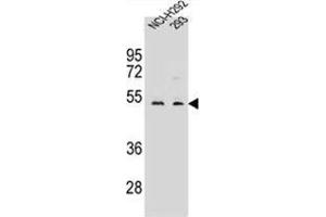 WDR86 Antibody (C-term) western blot analysis in NCI-H292,293 cell line lysates (35 µg/lane). (WDR86 抗体  (C-Term))
