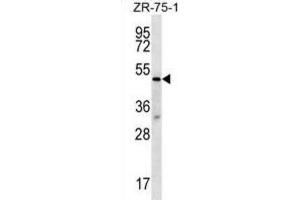 Western Blotting (WB) image for anti-Transducin (Beta)-Like 2 (TBL2) antibody (ABIN2996977) (TBL2 抗体)