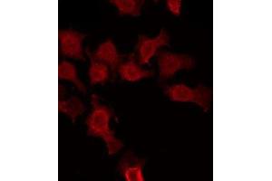 ABIN6275004 staining HuvEc by IF/ICC. (CLCNKA 抗体  (C-Term))