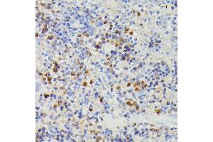 Immunohistochemistry of paraffin-embedded rat spleen using DUT antibody (ABIN7266736) at dilution of 1:100 (40x lens). (Deoxyuridine Triphosphatase (DUT) (AA 89-252) 抗体)