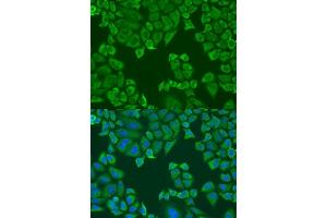 Immunofluorescence (IF) image for anti-Poly(A) Binding Protein, Cytoplasmic 4 (Inducible Form) (PABPC4) (AA 350-450) antibody (ABIN6145149)