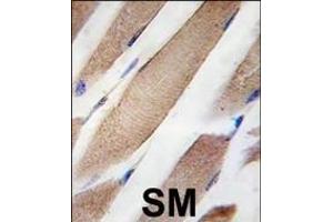 Formalin-fixed and paraffin-embedded human skeletal muscle tissue reacted with CLIC4 Antibody ABIN387769 , which was peroxidase-conjugated to the secondary antibody, followed by DAB staining. (CLIC4 抗体)
