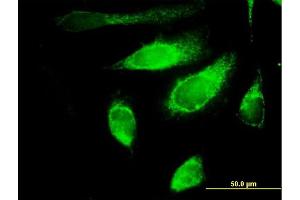 Immunofluorescence of purified MaxPab antibody to POLG2 on HeLa cell. (POLG2 抗体  (AA 1-485))