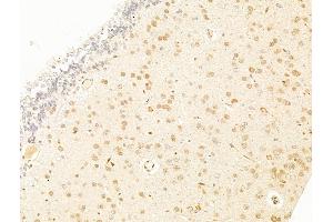 ABIN7094786 and ABIN7098837 at 1/100 staining Rat brain tissue by IHC-P.