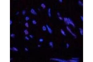 Immunofluorescence analysis of Human uterus tissue using CBX5 Monoclonal Antibody at dilution of 1:200. (CBX5 抗体)