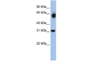 Western Blotting (WB) image for anti-Dehydrogenase/reductase (SDR Family) Member 2 (DHRS2) antibody (ABIN2458636) (DHRS2 抗体)