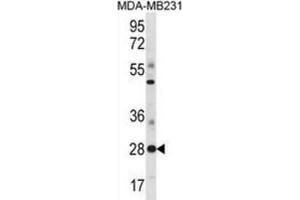 Western Blotting (WB) image for anti-Spi-B Transcription Factor (Spi-1/PU.1 Related) (SPIB) antibody (ABIN3000955) (SPIB 抗体)