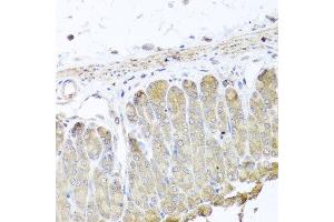 Immunohistochemistry of paraffin-embedded mouse stomach using IRS2 antibody at dilution of 1:100 (x40 lens).