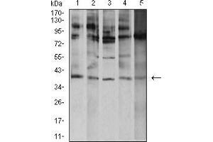Western blot analysis using ATF4 mouse mAb against K562 (1), A431 (2), Hela (3), HEK293 (4), and Ramos (5) cell lysate. (ATF4 抗体  (AA 212-351))