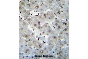 H2AFZ Antibody (C-term) (ABIN655184 and ABIN2844799) immunohistochemistry analysis in formalin fixed and paraffin embedded human liver tissue followed by peroxidase conjugation of the secondary antibody and DAB staining. (H2AFZ 抗体  (C-Term))
