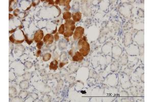 Immunoperoxidase of monoclonal antibody to HD on formalin-fixed paraffin-embedded human salivary gland. (Huntingtin 抗体  (AA 81-190))