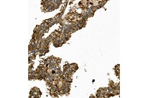 IHC analysis of REN/Renin using anti-REN/Renin antibody (ABIN7602836). (Renin 抗体  (C-Term))