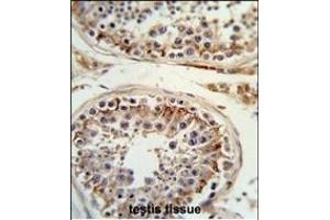 Formalin-fixed and paraffin-embedded human testis tissue reacted with ITGB3 Antibody (C-term), which was peroxidase-conjugated to the secondary antibody, followed by DAB staining. (Integrin beta 3 抗体  (C-Term))