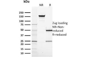 SDS-PAGE Analysis Purified RNA Poll II Mouse Monoclonal Antibody (CTD4H8). (POLR2A/RPB1 抗体  (pSer5))