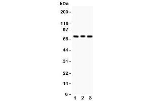 Western blot testing of PKC beta antibody and Lane 1:  rat brain (Pkc beta 1 抗体  (AA 542-671))