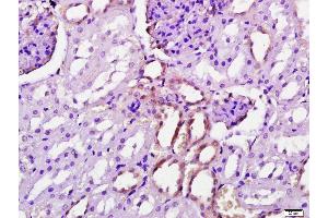 Immunohistochemistry (Paraffin-embedded Sections) (IHC (p)) image for anti-Adaptor-Related Protein Complex 1, gamma 1 Subunit (AP1G1) (AA 721-822) antibody (ABIN731873)