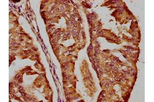 Immunohistochemistry (IHC) image for anti-Dicer 1, Ribonuclease Type III (DICER1) (AA 1721-1922) antibody (ABIN7151707)
