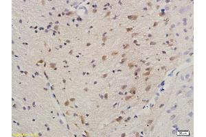 Formalin-fixed and paraffin embedded rat brain labeled with Anti-HDAC3/HD3 Polyclonal Antibody, Unconjugated (ABIN734903) at 1:200 followed by conjugation to the secondary antibody and DAB staining. (HDAC3 抗体)