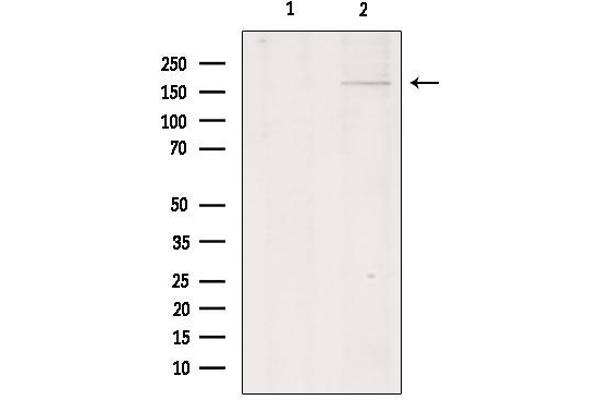 COL11A1 抗体  (Internal Region)