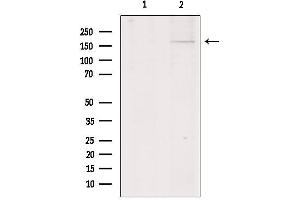 Western blot analysis of extracts from HepG2, using Collagen XIalpha 1 Antibody. (COL11A1 抗体  (Internal Region))
