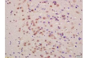 Immunohistochemistry (Paraffin-embedded Sections) (IHC (p)) image for anti-Solute Carrier Family 7 (Cationic Amino Acid Transporter, Y+ System), Member 5 (SLC7A5) (AA 101-200) antibody (ABIN1387470)
