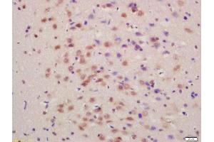 Formalin-fixed and paraffin embedded rat brain labeled with Anti-SLC7A5 Polyclonal Antibody, Unconjugated  at 1:200 followed by conjugation to the secondary antibody and DAB staining (SLC7A5 抗体  (AA 101-200))