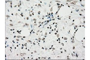 Image no. 8 for anti-TYRO3 Protein Tyrosine Kinase (TYRO3) antibody (ABIN1501607)