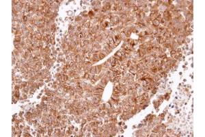 IHC-P Image Immunohistochemical analysis of paraffin-embedded H520 xenograft, using Histamine H2 Receptor, antibody at 1:100 dilution. (HRH2 抗体  (N-Term))