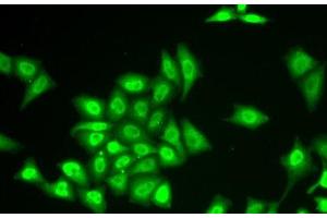 Immunofluorescence analysis of U2OS cells using ZNF217 Polyclonal Antibody (ZNF217 抗体)
