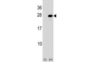 Western blot analysis of ATF3 antibody and 293 cell lysate (2 ug/lane) either nontransfected (Lane 1) or transiently transfected (2) with the ATF3 gene. (ATF3 抗体  (AA 140-168))