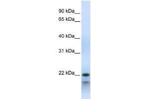 WB Suggested Anti-POLR3H Antibody Titration:  0. (POLR3H 抗体  (Middle Region))