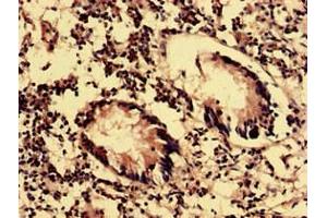 Immunohistochemistry analysis of human appendix tissue using ABIN7162151 at dilution of 1:100 (OLFML2B 抗体  (AA 451-750))
