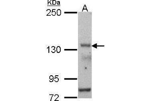 WB Image Sample (30 ug of whole cell lysate) A: HCT116 5% SDS PAGE antibody diluted at 1:500 (POLR3A 抗体  (N-Term))